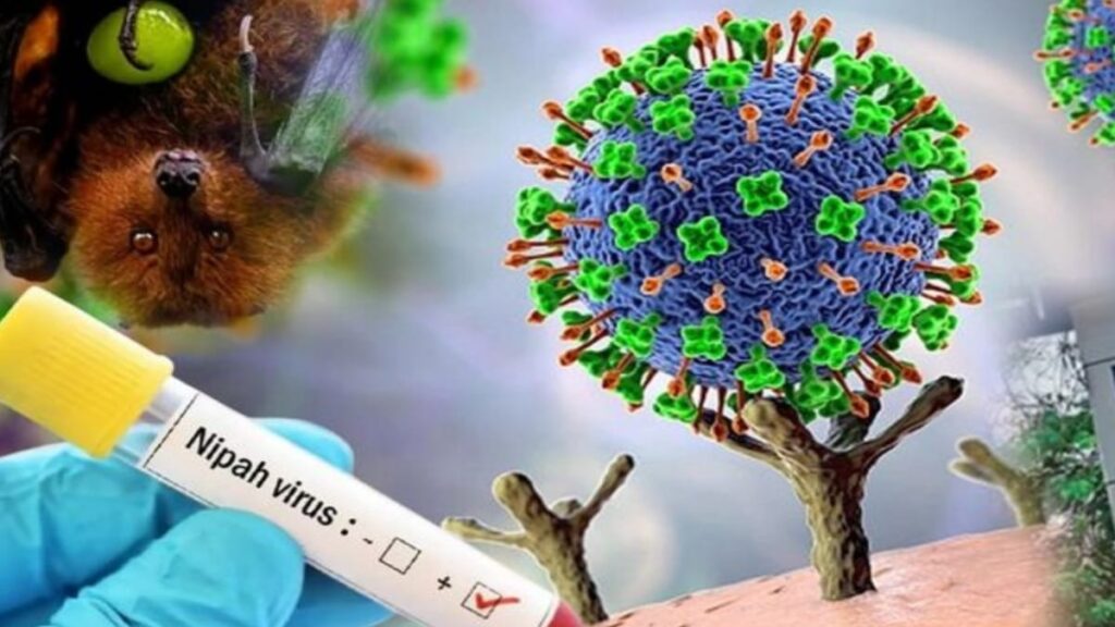 Nipah virus